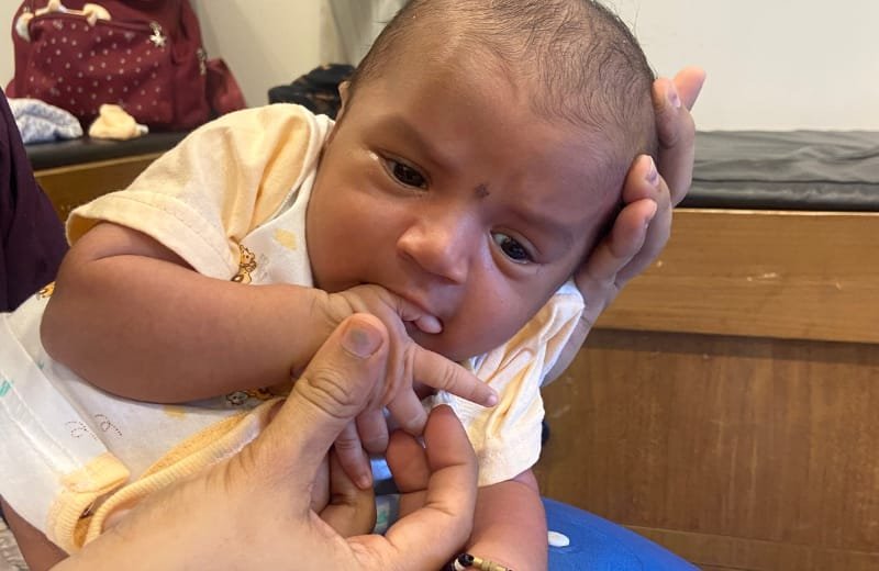 Erb’s Palsy euroone physio