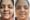 Bells palsy neuroone physio