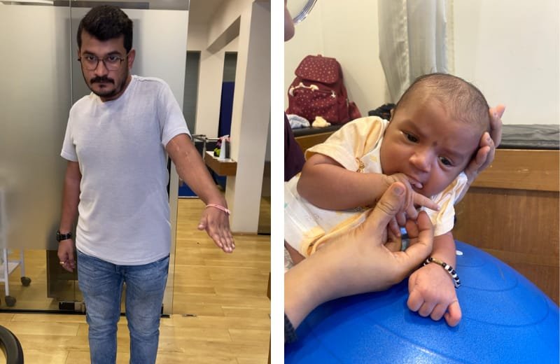 Brachial Plexus Injury neuroone physio