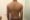 Scoliosis neuroone physio