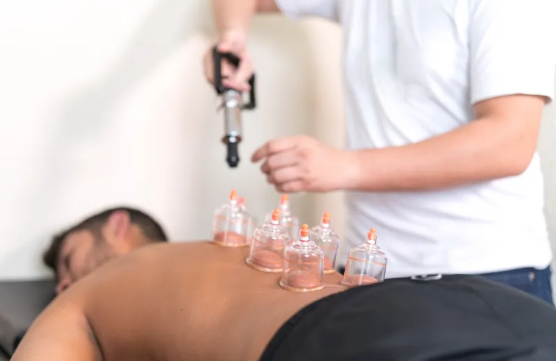 Cupping Therapy NeuroOne Physio